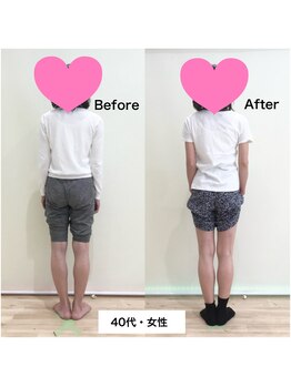 こんだ整骨院/O脚改善ビフォーアフター