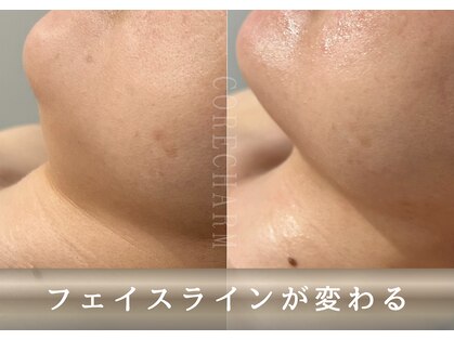 コア チャーム(CORE CHARM)の写真