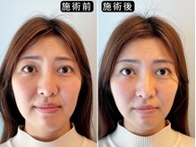 アオヤマ サロン ワイゼット(AOYAMA SALON YZ)/ビフォーアフター