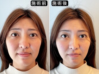 アオヤマ サロン ワイゼット(AOYAMA SALON YZ)/ビフォーアフター