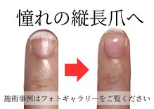 リング ザ ベル(ring the bell)