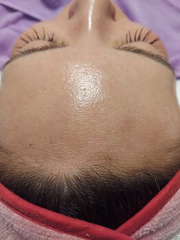 キアラ 麻布十番(Kiara)/顔脱毛　ブラジリアンワックス