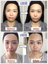 整体サロン プラスエル 東向島(Plus L)/小顔★ビフォーアフター