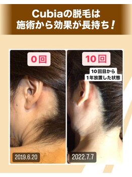 エステティックサロン キュビア(Cubia)/当店施術のお客様　10回の効果