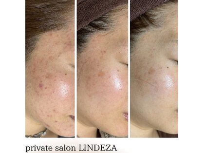 リンデザ(LINDEZA)の写真