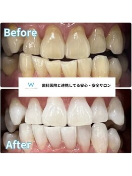 ホワイトニングショップ 豊田店(WHITENING SHOP)/歯科医師提携サロン!