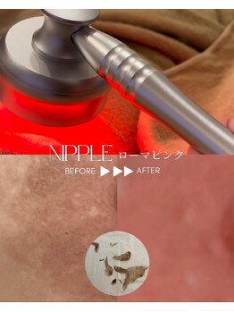 リュミエール デスポワール(Lumiere d'espoir)/ローマピンク