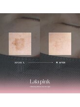 フレイヤビューティー スハダラボ 恵比寿(Freyia Beauty Suhada LABO)/-ララピンク-