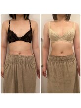 美人バスト 浜松店/◇ バストアップ &nbsp;BeforeAfter◇