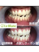 ルブラン 奈良店(Le Blanc)/ご自身に合ったペースで