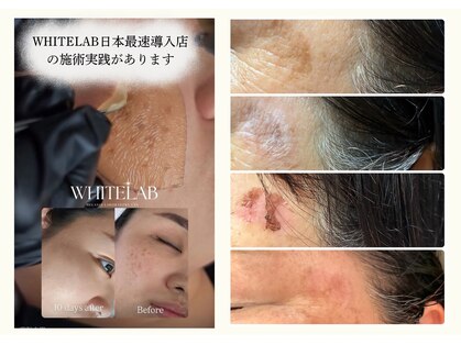 ラヌイ(LANUI)の写真