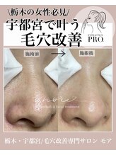 モア(MORE)/