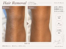 サロンアールミヨン(Salon R Miyon)の雰囲気（結果重視脱毛♪通うほど実感◎冬も温ジェルで寒さを気にせず快適）
