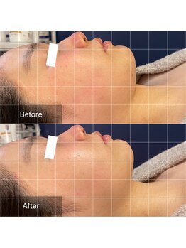 フフラ KANコルギセラピー山梨本店(fufla)/小顔コルギ　小顔ソムリエ　