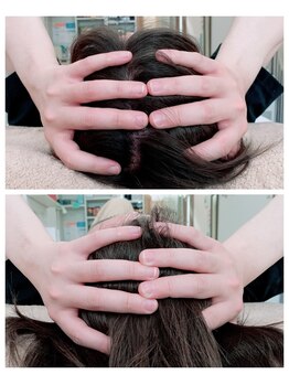 イロドリ ボディ アンド フェイス(irodori. body & face)/当店の小顔矯正は骨から変わる♪