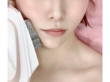 ネイルアンドエステティック デイズ 三好中央店(Days)/全身脱毛　【VIO込み】