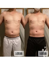 セイリキ(SEIRIKI)/★痩身ダイエットお客様のお声★