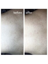 エムユー(Mu)/背毛と角栓はワックスで綺麗に☆