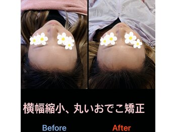 美容矯正サロン レレポノ(LELEPONO)/