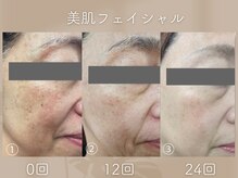 ミシェリ(MCHERI)の雰囲気（フェイシャルエステも可能◎【小顔/フェイシャル/毛穴ケア】）