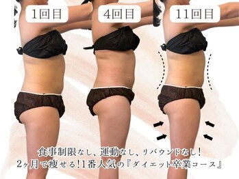 ヨサパーク エラ 恵比寿西(YOSA PARK Ella)/ダイエット卒業コース11回