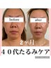 【極上エラスチン導入たるみフェイシャル】60分 ¥11,000→