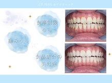 シープラス(CY PLUS)