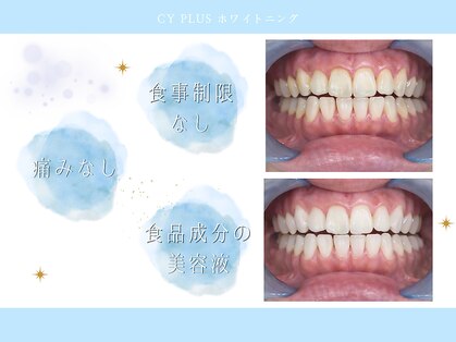 シープラス(CY PLUS)の写真