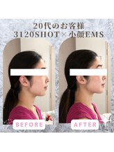 ラ セラフィータ 中目黒/【上級小顔】EMS美容液導入付き