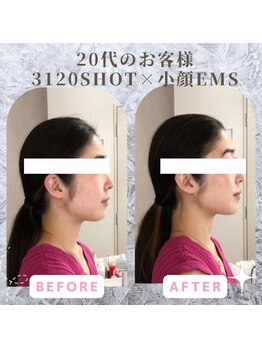 ラ セラフィータ 中目黒/【上級小顔】EMS美容液導入付き