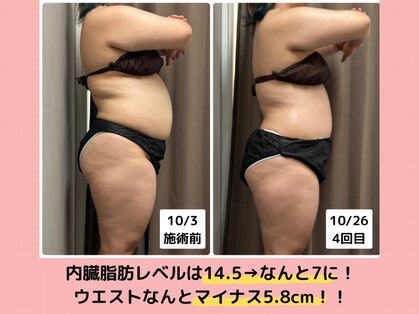 おにぎり(ONIGIRI)の写真