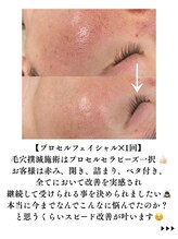 レイ(Rey)/頑固な毛穴開きにはプロセル一択