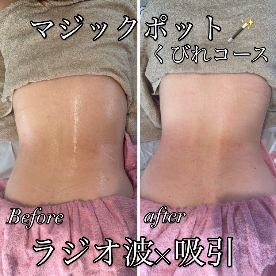 ゆでたまご｜ホットペッパービューティー