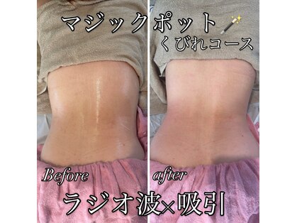 ゆでたまごの写真