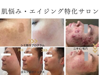 アクシア(Axia)の写真