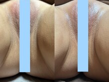 スリール(sourire)/話題のフェムケア