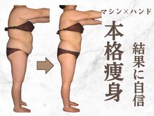 トータルエステサロン ヴィビ(Vi-Bi)