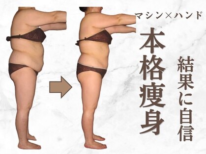 トータルエステサロン ヴィビ(Vi-Bi)の写真