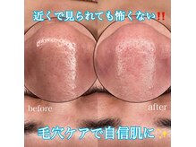 エステサロン クブ(Kubu)の雰囲気（プラズマシャワ&光トーニング　毛穴開き　黒ずみ）