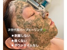 アロー(Allo!)/ソフトハーブピーリング