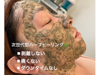 アロー(Allo!)/ソフトハーブピーリング