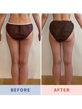 マナワ(Manawa)/お客様４回目のビフォーアフター