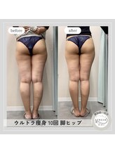 カラー(CALLA)/キュッと上がった小尻に♪