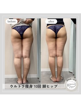 カラー(CALLA)/キュッと上がった小尻に♪