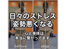 カワル整体 上通り院/ストレスで姿勢崩れます。