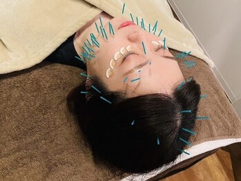 アウルハリハリ 鳳院(OWL hair-hari)の写真/４０～５０代のお悩みNO１の「たるみ/しわケア」に特化した美容鍼灸サロンが鳳に！ぜひお越しください◎