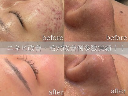 サロン ド ペオニー 川内店(salon de peony)の写真