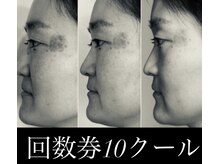 ミミルーチェ(mimiluce)/2ヶ月半で衝撃変化◎ダブル蒸し