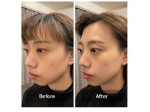 ベンザイ 梅田店(BENZAI)/お疲れ顔、スマホ首