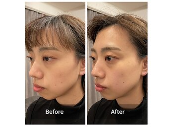 ベンザイ 梅田店(BENZAI)/お疲れ顔、スマホ首